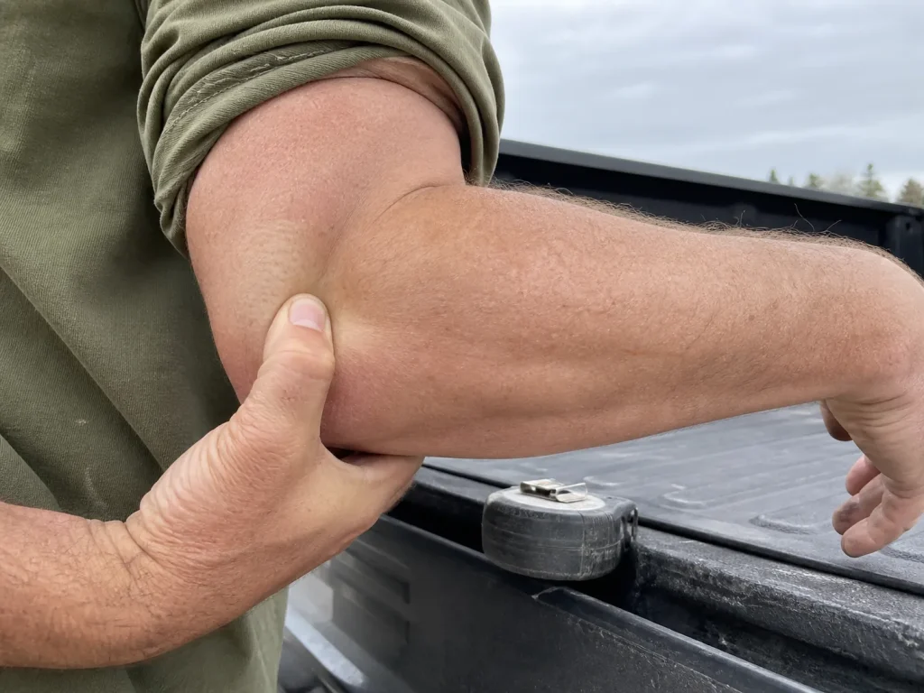 Close-up of an angler pressing his thumb into the outside of his elbow to locate angler's elbow pain